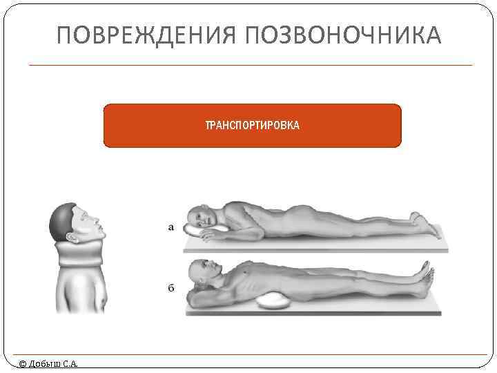 ПОВРЕЖДЕНИЯ ПОЗВОНОЧНИКА ТРАНСПОРТИРОВКА © Добыш С. А. 