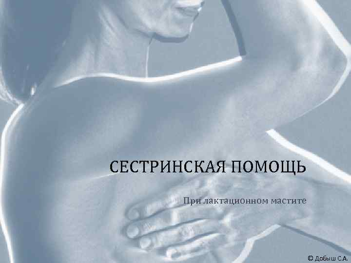 СЕСТРИНСКАЯ ПОМОЩЬ При лактационном мастите © Добыш С. А. 