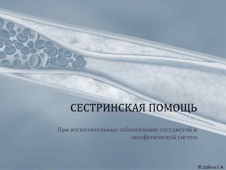 СЕСТРИНСКАЯ ПОМОЩЬ При воспалительных заболеваниях сосудистой и лимфатической систем © Добыш С. А. 