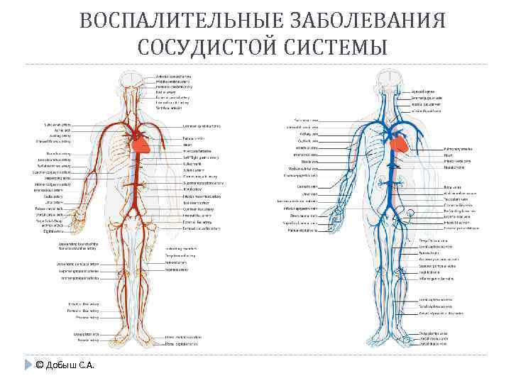 ВОСПАЛИТЕЛЬНЫЕ ЗАБОЛЕВАНИЯ СОСУДИСТОЙ СИСТЕМЫ © Добыш С. А. 