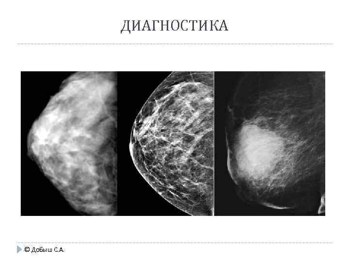 ДИАГНОСТИКА © Добыш С. А. 