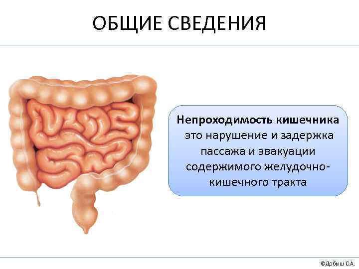 ОБЩИЕ СВЕДЕНИЯ Непроходимость кишечника это нарушение и задержка пассажа и эвакуации содержимого желудочнокишечного тракта