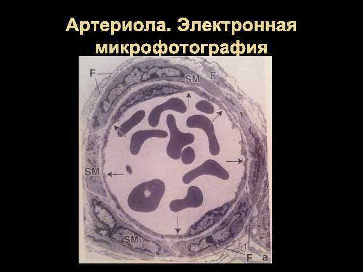 Артериола. Электронная микрофотография 