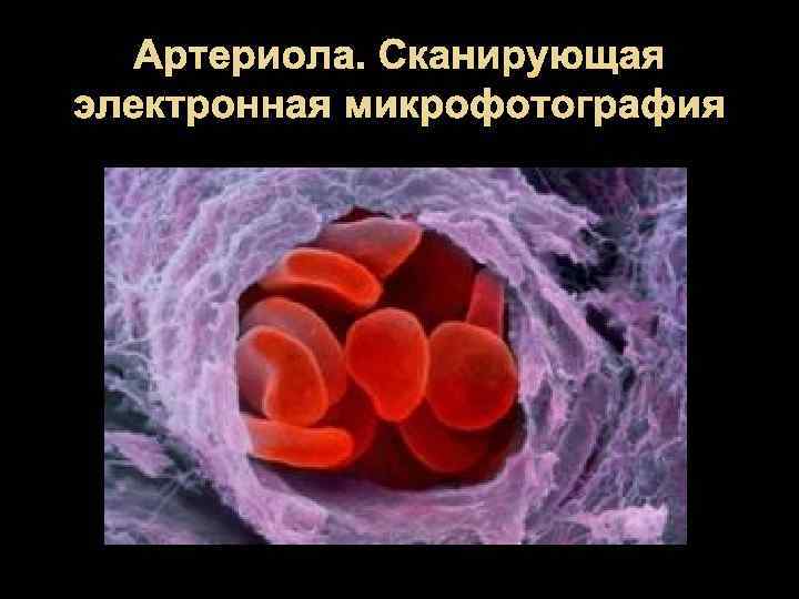 Артериола. Сканирующая электронная микрофотография 