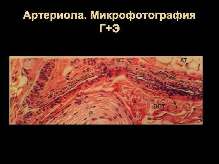 Артериола. Микрофотография Г+Э 