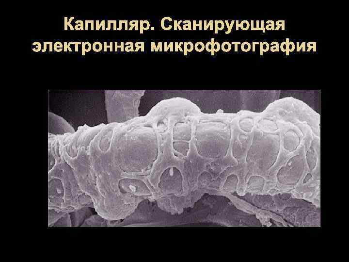 Капилляр. Сканирующая электронная микрофотография 