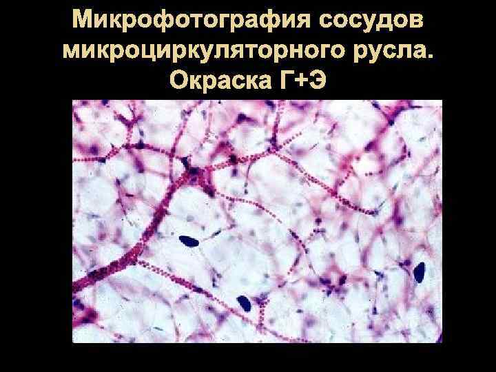 Микроциркуляторное русло гистология рисунок