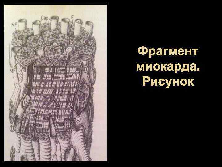 Фрагмент миокарда. Рисунок 