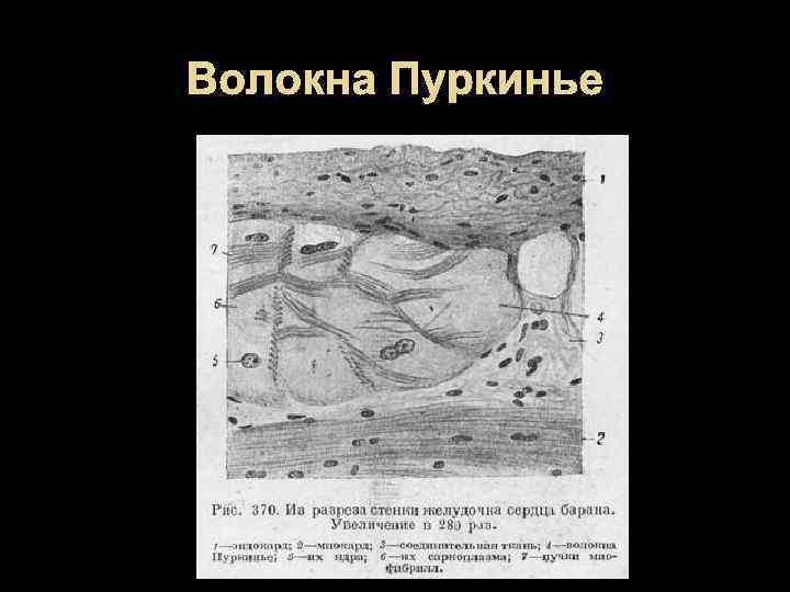 Волокна Пуркинье 