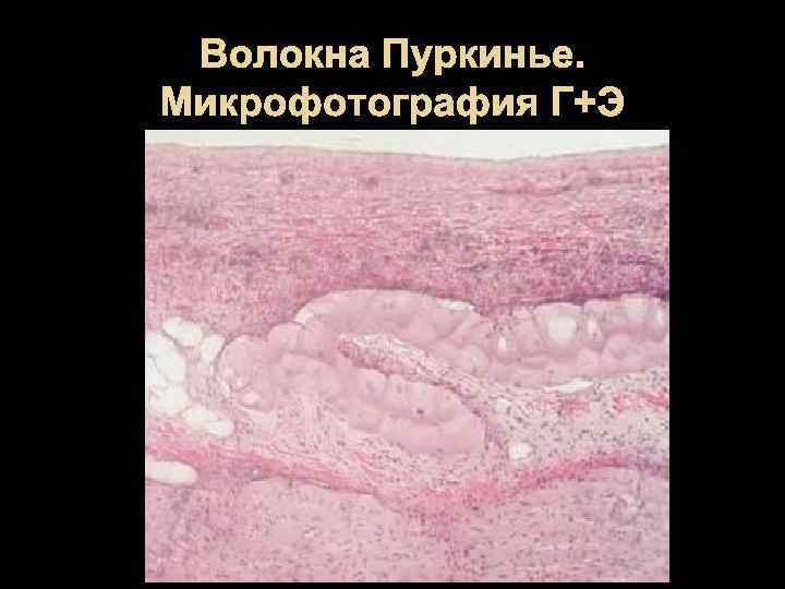 Волокна Пуркинье. Микрофотография Г+Э 