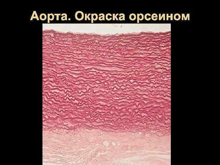 Аорта. Окраска орсеином 