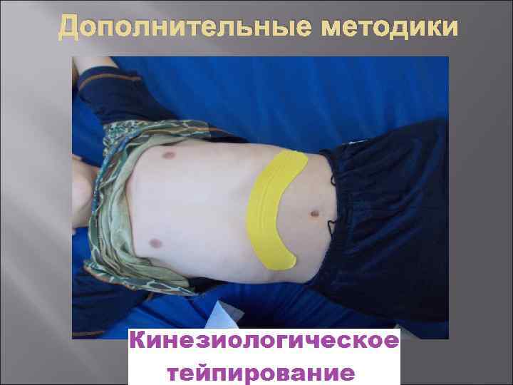 Дополнительные методики 