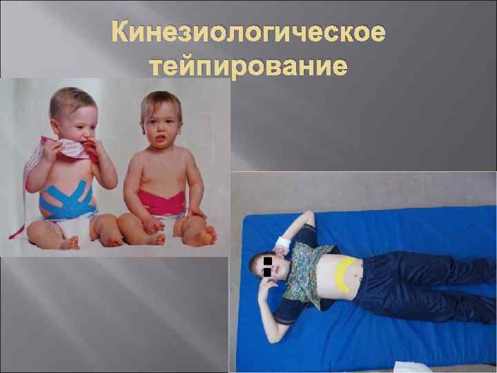 Кинезиологическое тейпирование 