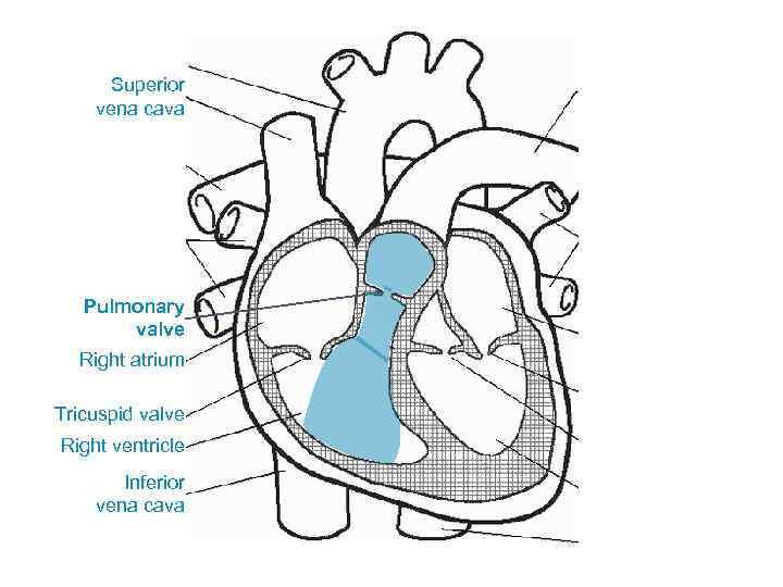 Superior vena cava Pulmonary valve Right atrium Tricuspid valve Right ventricle Inferior vena cava