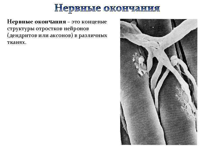 Нервные окончания – это концевые структуры отростков нейронов (дендритов или аксонов) в различных тканях.