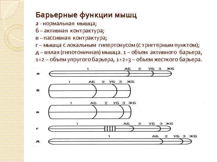 Барьерные функции мышц а - нормальная мышца; б – активная контрактура; в – пассивная