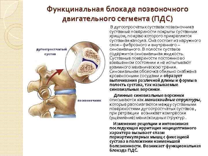 Функцинальная блокада позвоночного двигательного сегмента (ПДС) В дугоотросчатых суставах позвоночника суставные поверхности покрыты суставным