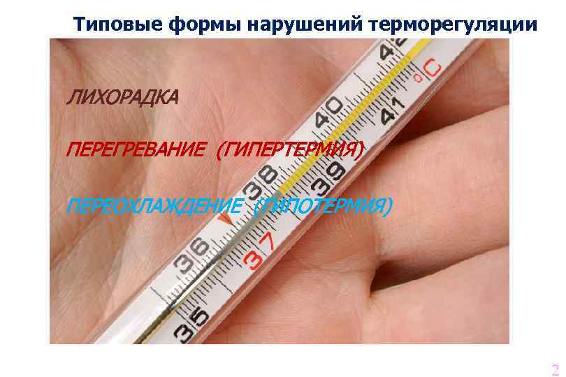 Типовые формы нарушений терморегуляции ЛИХОРАДКА ПЕРЕГРЕВАНИЕ (ГИПЕРТЕРМИЯ) ПЕРЕОХЛАЖДЕНИЕ (ГИПОТЕРМИЯ) 2 