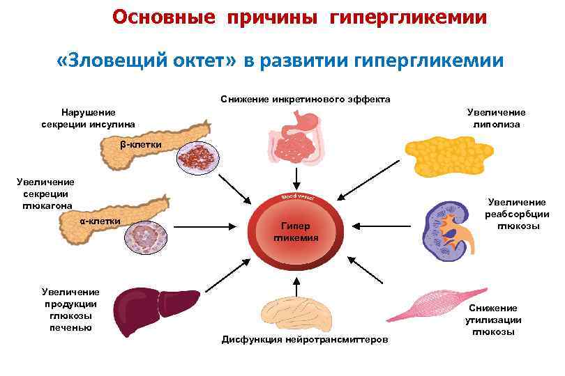 Уровни гипергликемии