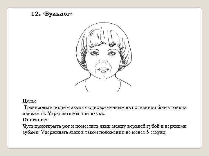 12. «Бульдог» Цель: Тренировать подъём языка с одновременным выполнением более тонких движений. Укреплять мышцы