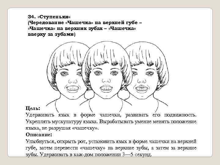 34. «Ступеньки» (Чередование «Чашечка» на верхней губе – «Чашечка» на верхних зубах – «Чашечка»
