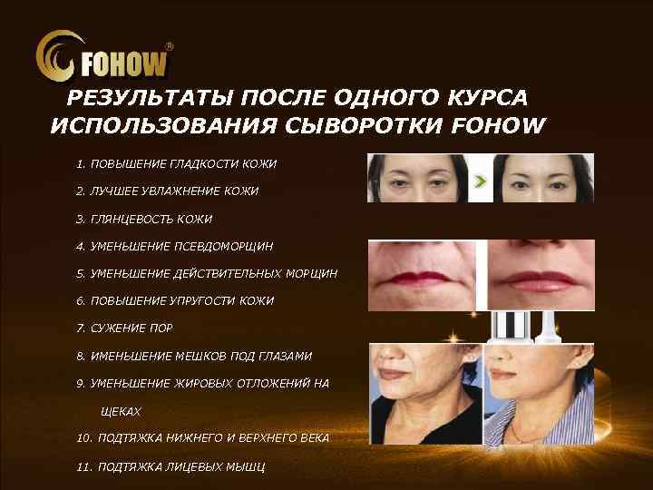 РЕЗУЛЬТАТЫ ПОСЛЕ ОДНОГО КУРСА ИСПОЛЬЗОВАНИЯ СЫВОРОТКИ FOHOW 1. ПОВЫШЕНИЕ ГЛАДКОСТИ КОЖИ 　　　　　　　 2. ЛУЧШЕЕ