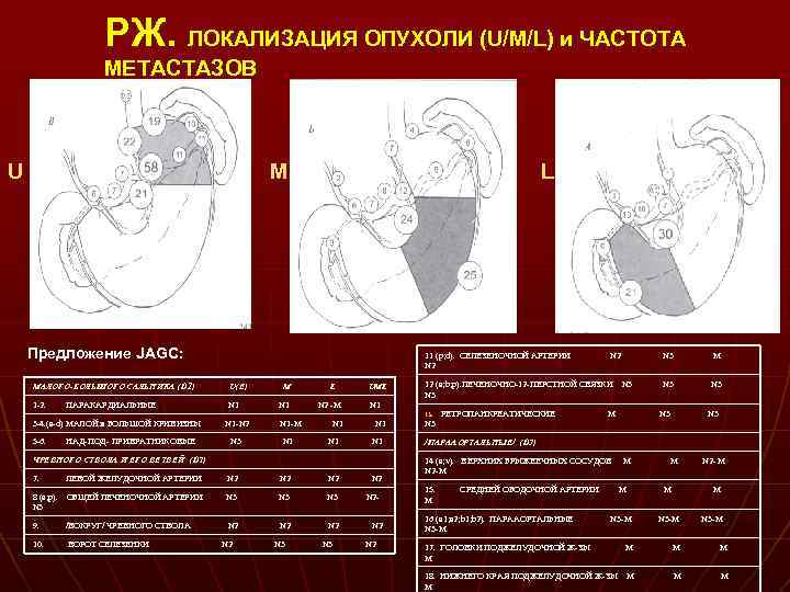 РЖ. ЛОКАЛИЗАЦИЯ ОПУХОЛИ (U/M/L) и ЧАСТОТА МЕТАСТАЗОВ U M L Предложение JAGC: 11 (p;