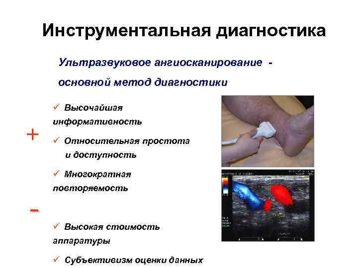 Инструментальная диагностика Ультразвуковое ангиосканирование основной метод диагностики ü Высочайшая + информативность ü Относительная простота