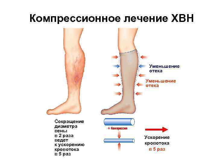 Алкогольная полинейропатия нижних конечностей карта вызова смп