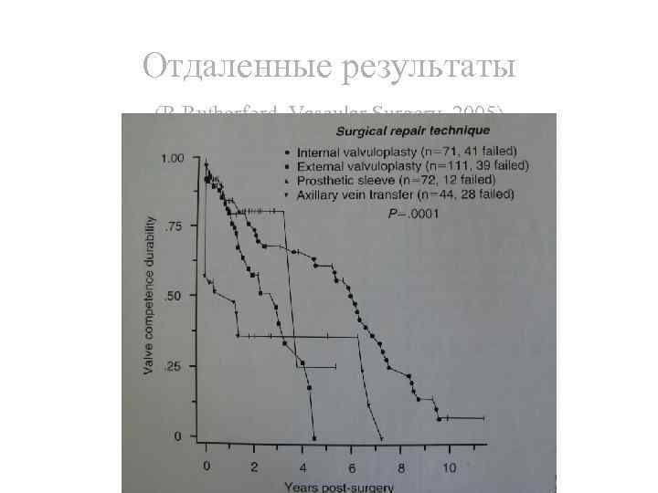 Отдаленные результаты (R. Rutherford, Vascular Surgery, 2005) 