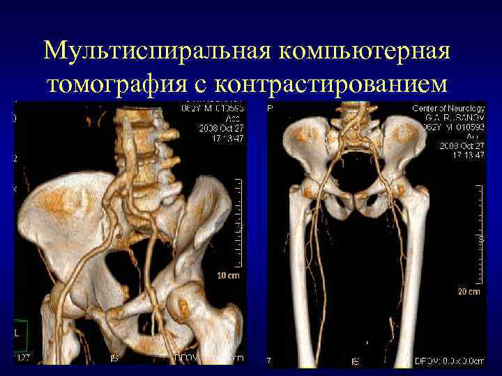 Мскт с контрастированием. Мультиспиральная кт. Мультиспиральная многослойная компьютерная томография. Мультиспиральная различия с кт.