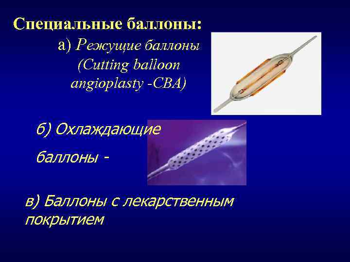 Специальные баллоны: а) Режущие баллоны (Сutting balloon angioplasty -CBA) б) Охлаждающие баллоны в) Баллоны