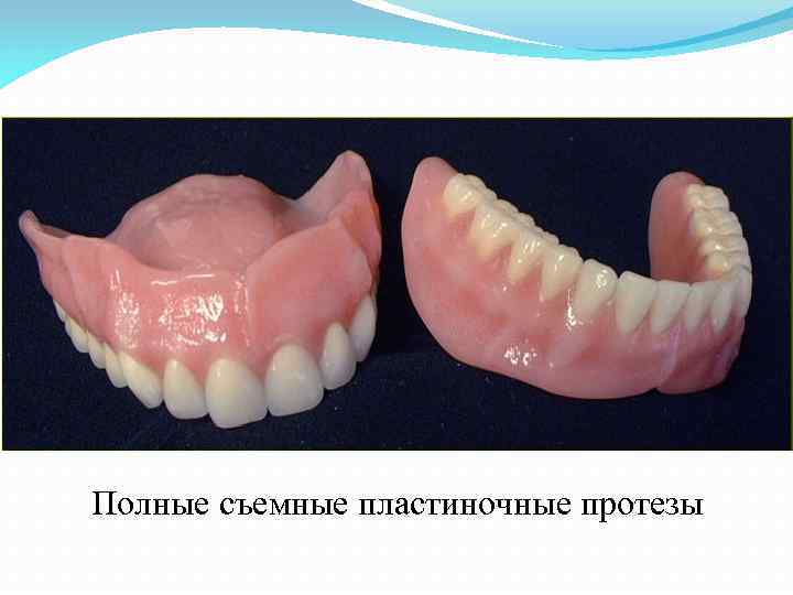 Полные съемные пластиночные протезы 