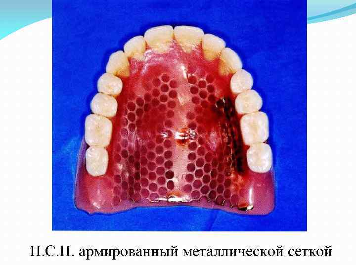 П. С. П. армированный металлической сеткой 