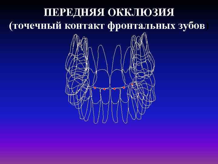 Вертикальная окклюзия. Точечный контакт. Трех точечный контак в окклюзии.