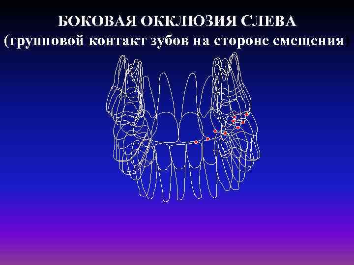 БОКОВАЯ ОККЛЮЗИЯ СЛЕВА (групповой контакт зубов на стороне смещения) 