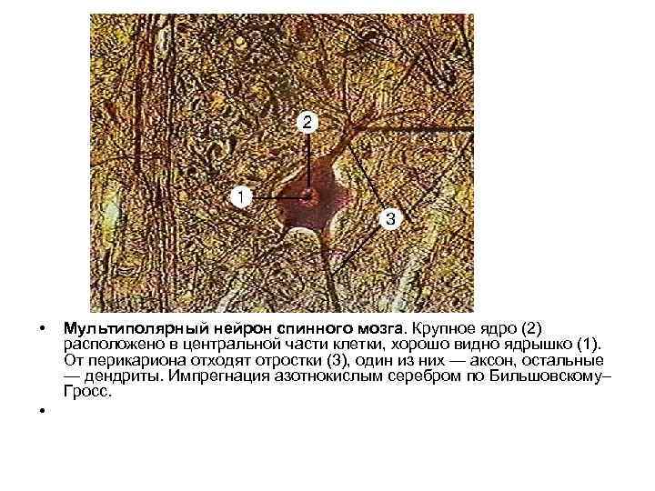  • • Мультиполярный нейрон спинного мозга. Крупное ядро (2) расположено в центральной части