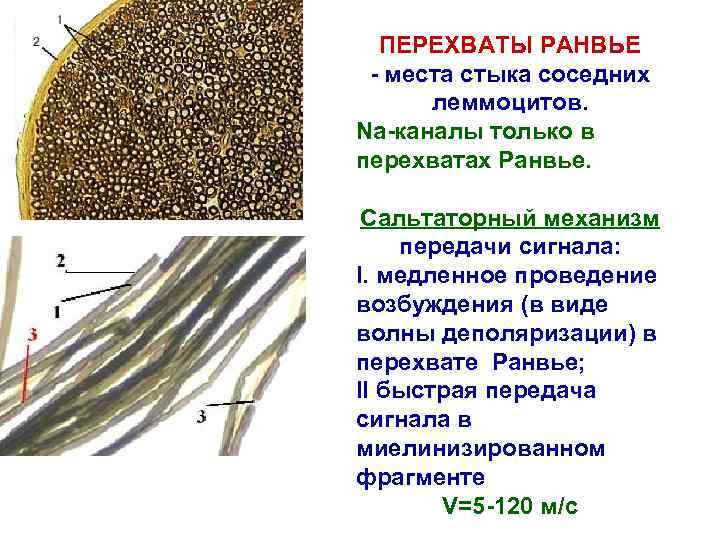 ПЕРЕХВАТЫ РАНВЬЕ - места стыка соседних леммоцитов. Na-каналы только в перехватах Ранвье. Сальтаторный механизм