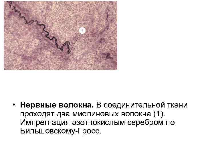 • Нервные волокна. В соединительной ткани проходят два миелиновых волокна (1). Импрегнация азотнокислым