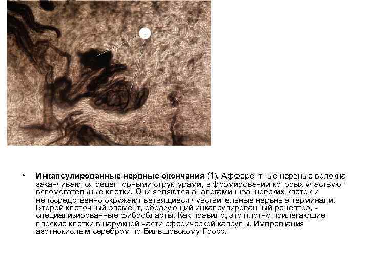  • Инкапсулированные нервные окончания (1). Афферентные нервные волокна заканчиваются рецепторными структурами, в формировании