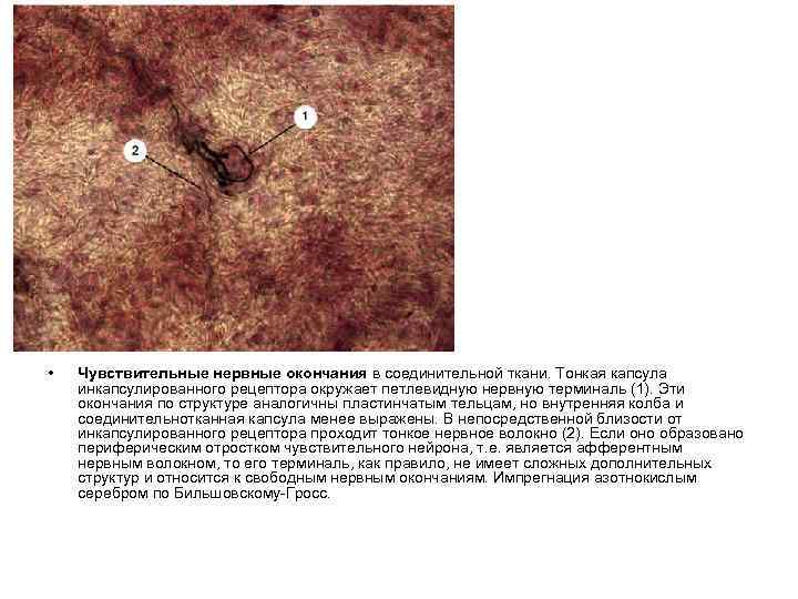  • Чувствительные нервные окончания в соединительной ткани. Тонкая капсула инкапсулированного рецептора окружает петлевидную
