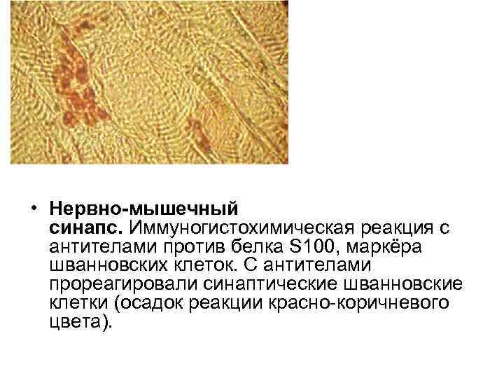  • Нервно-мышечный синапс. Иммуногистохимическая реакция с антителами против белка S 100, маркёра шванновских