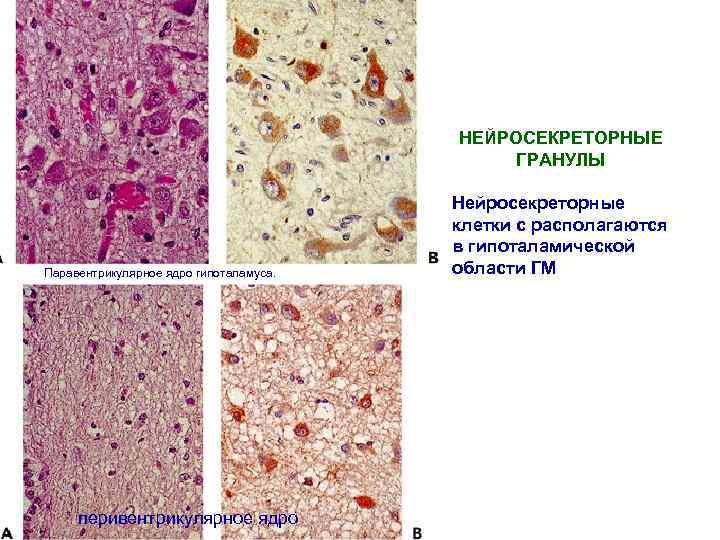 НЕЙРОСЕКРЕТОРНЫЕ ГРАНУЛЫ Паравентрикулярное ядро гипоталамуса. перивентрикулярное ядро Нейросекреторные клетки с располагаются в гипоталамической области