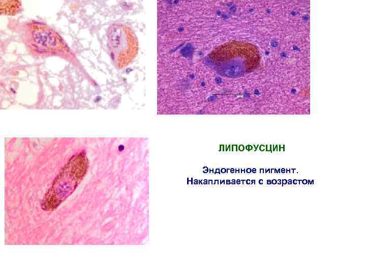 ЛИПОФУСЦИН Эндогенное пигмент. Накапливается с возрастом 