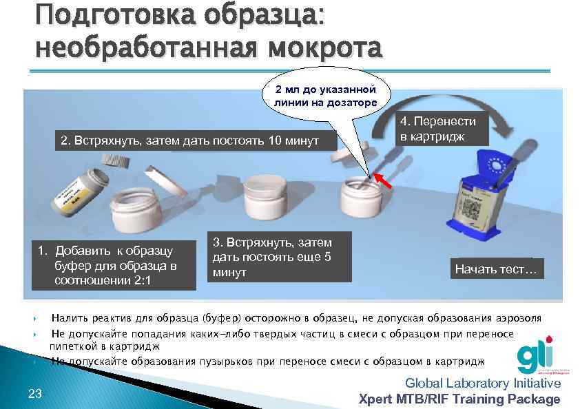 Подготовка образца: необработанная мокрота 2 мл до указанной линии на дозаторе 2. Встряхнуть, затем