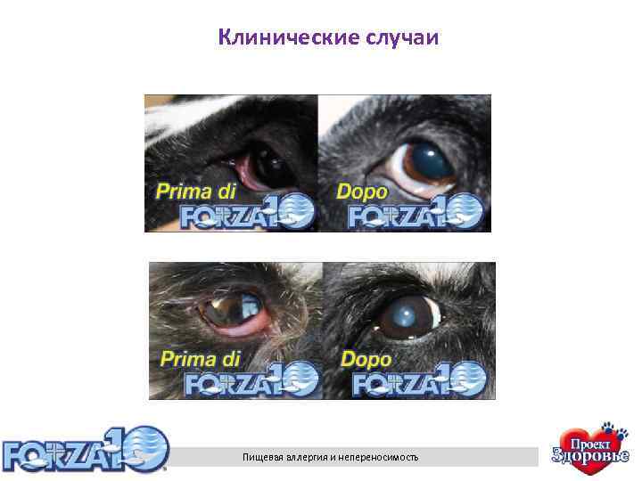 Клинические случаи Пищевая аллергия и непереносимость 