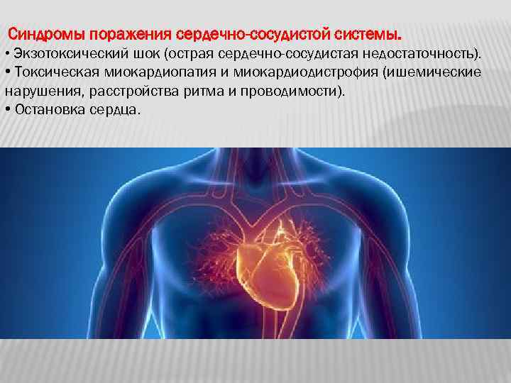  Синдромы поражения сердечно-сосудистой системы. • Экзотоксический шок (острая сердечно-сосудистая недостаточность). • Токсическая миокардиопатия