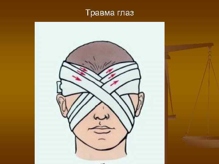 Травма глаз 