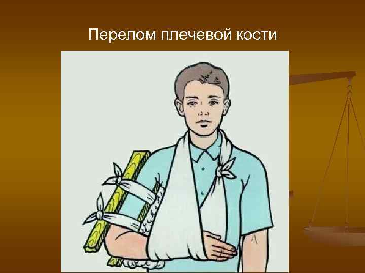 Перелом плечевой кости 