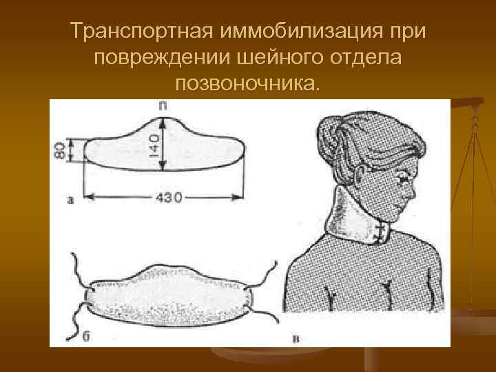 Транспортная иммобилизация при повреждении шейного отдела позвоночника. 